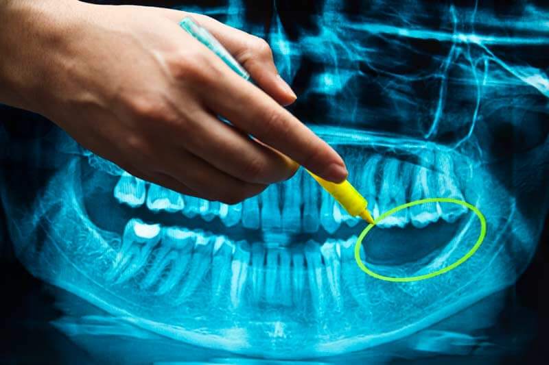 Dental Implants in Arlington, VA